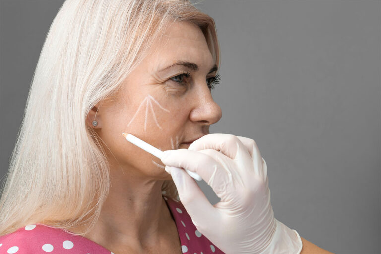 Using Fillers vs. Having a Facelift