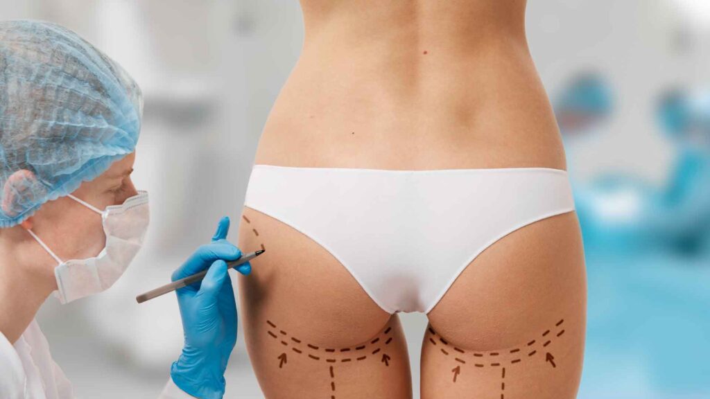 Corrective procedure